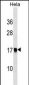 AP2S1 Antibody (Center)
